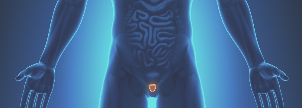 Skeletal diagram showing a highlighted prostate