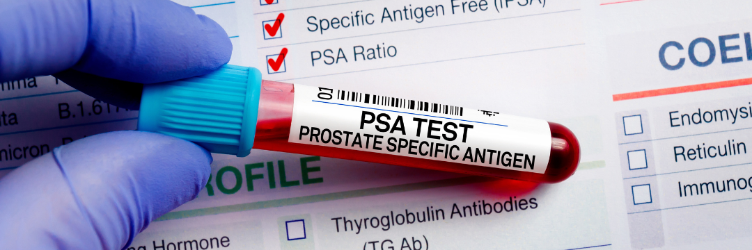 Purple glove holding PSA test tube by the cap over diagnostic paper